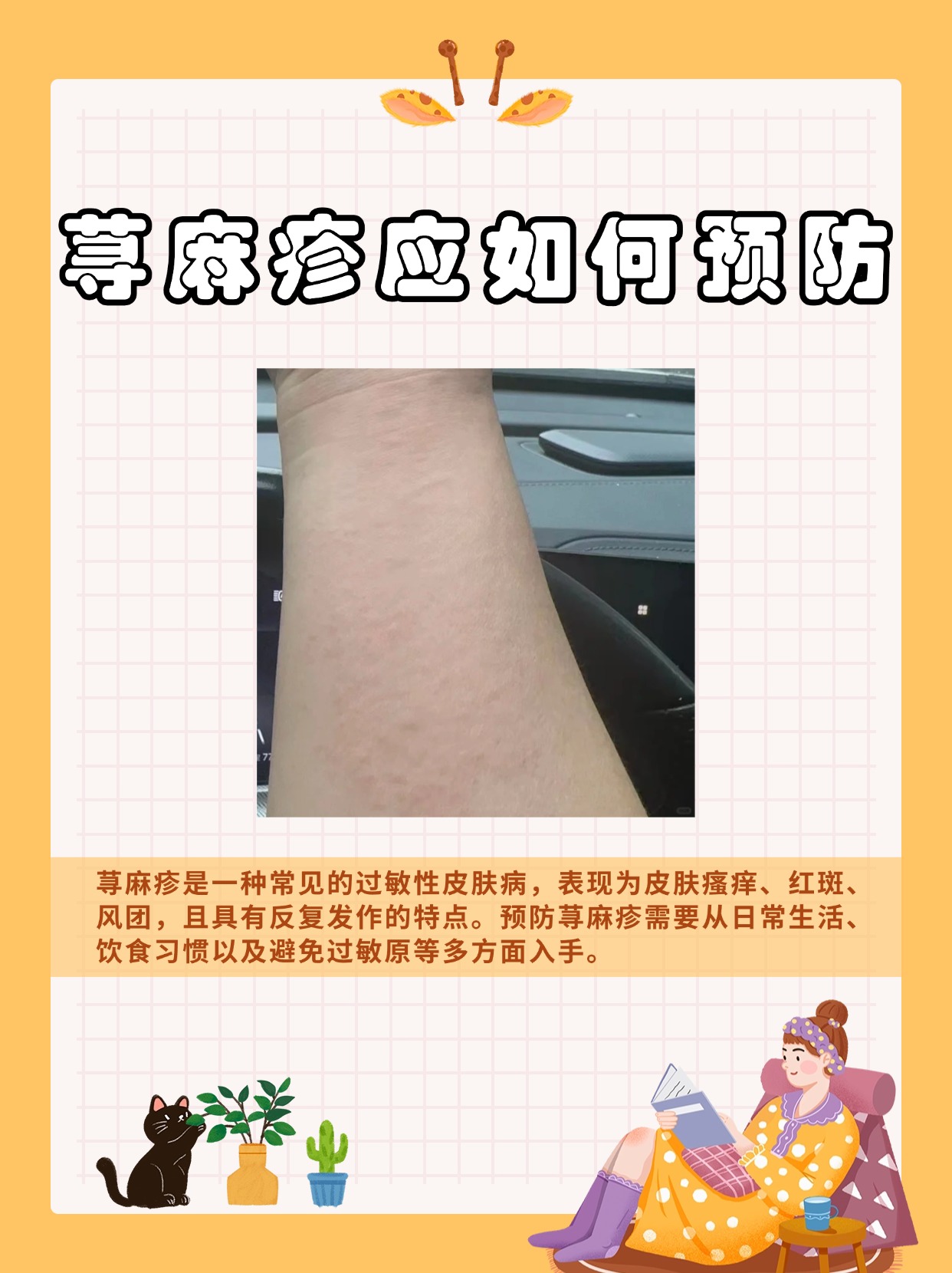 荨麻疹是因为什么原因导致的呢