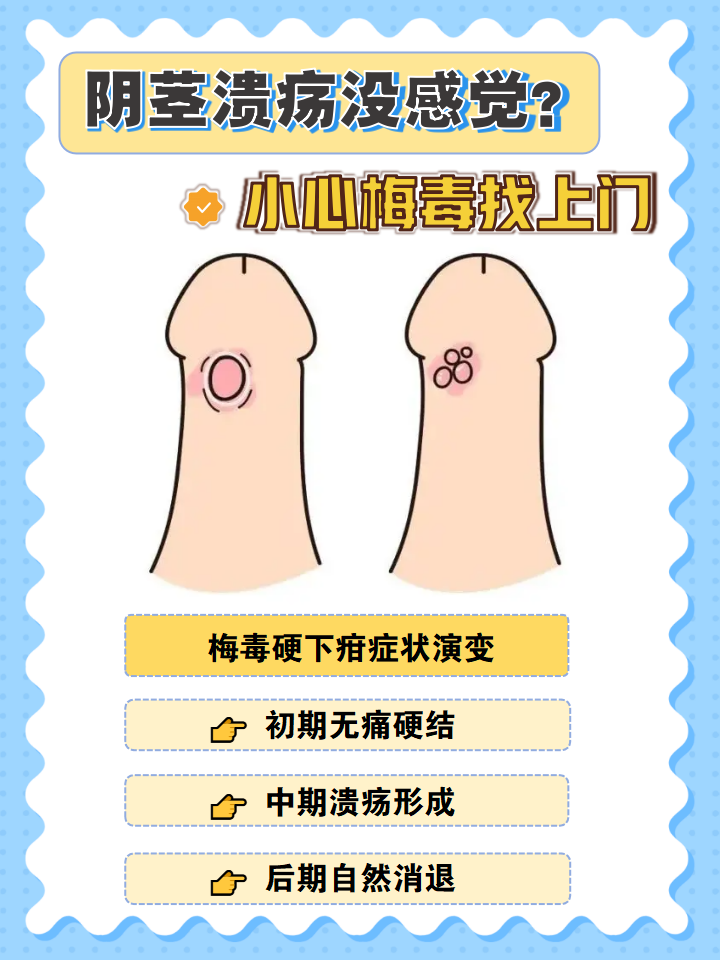 硬下疳初期图片