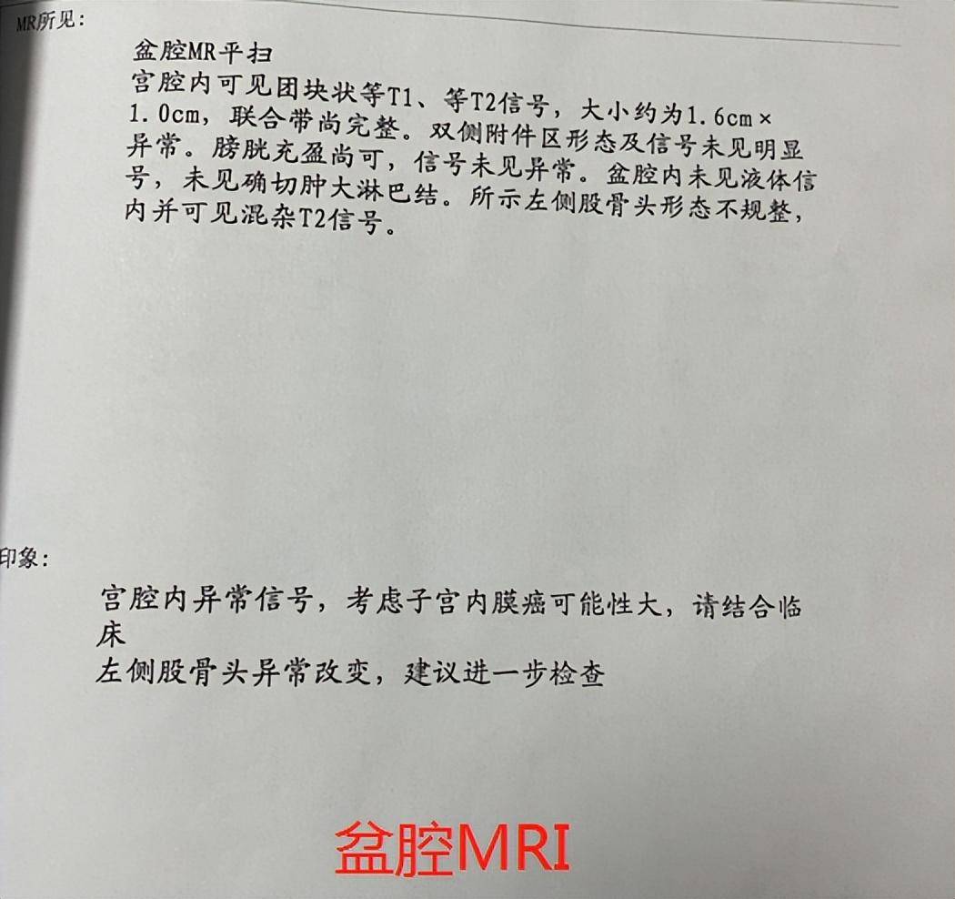 诊刮术后注意事项
