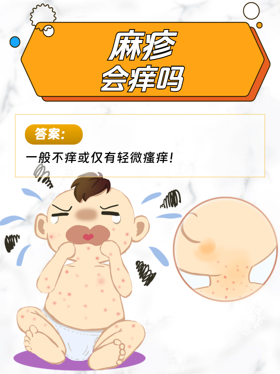 麻疹的传播途径?