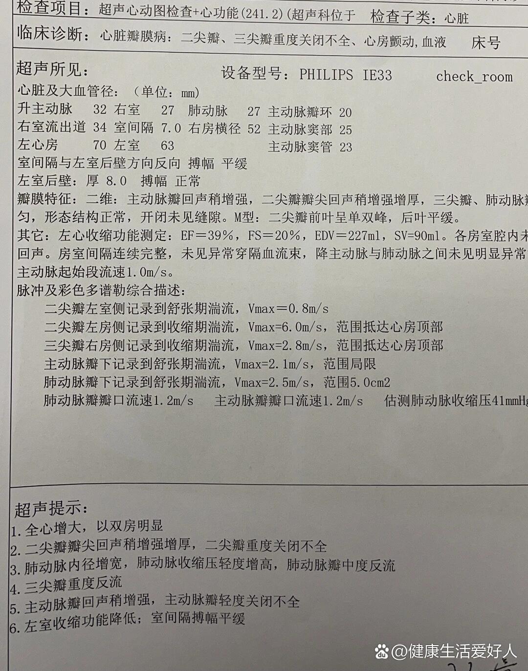 三尖瓣轻度返流是什么意思啊