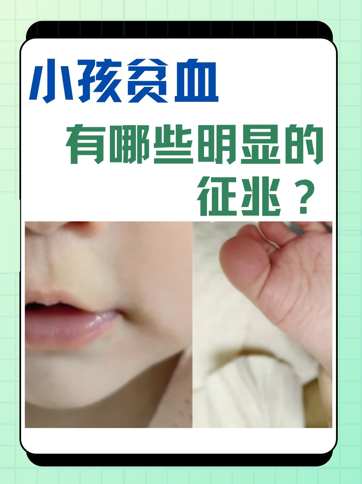 贫血的症状是什么
