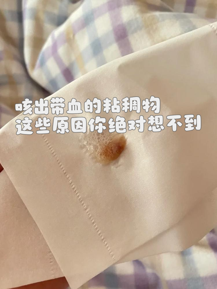 血液粘稠的原因有几种