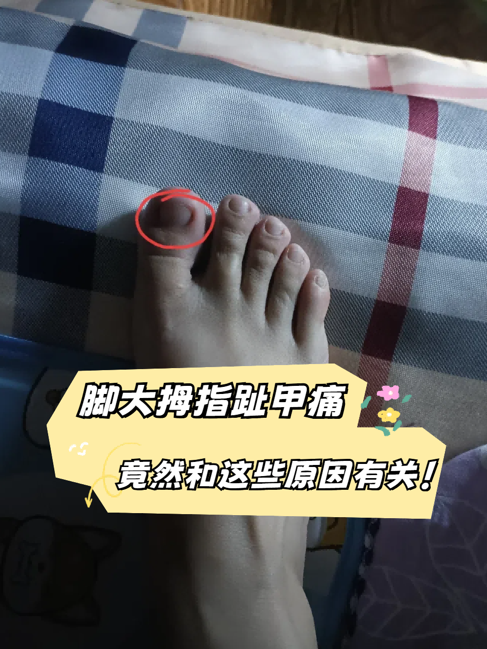 脚大拇指麻木怎么办?