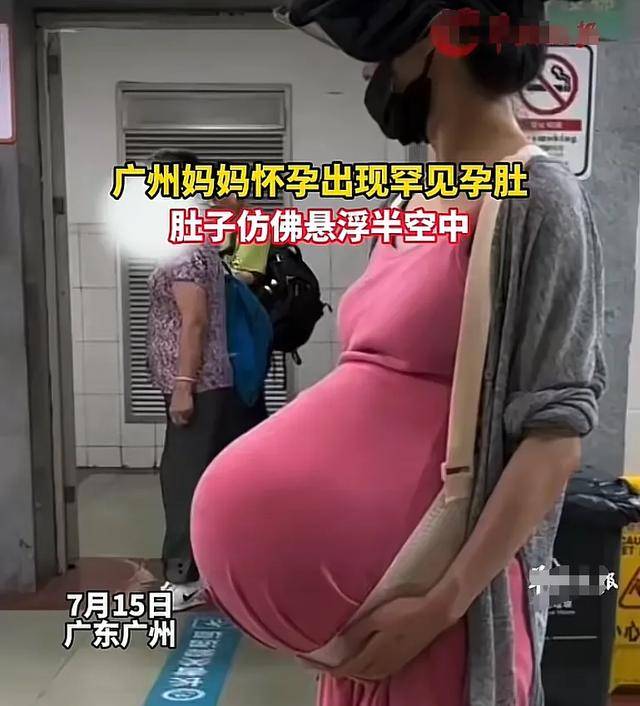 死胎孕妇有什么症状