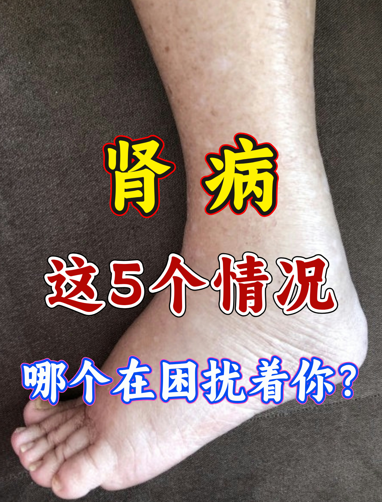 肾坏死的症状