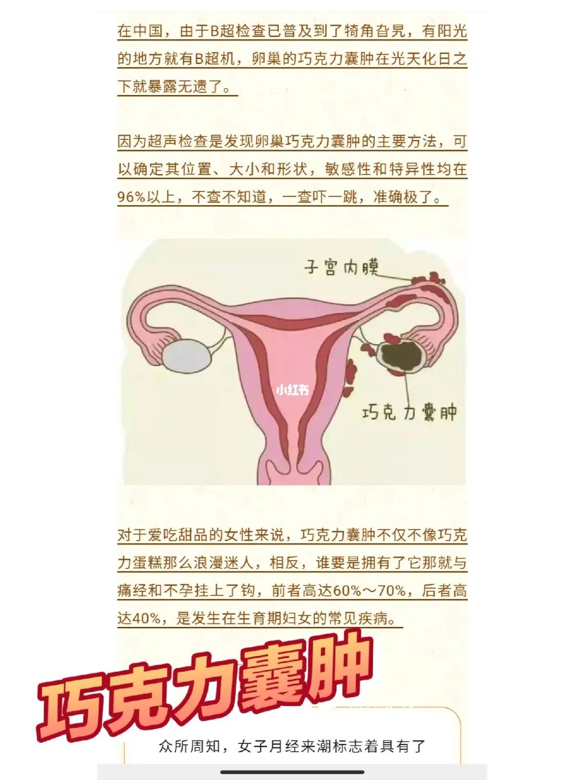 巧克力囊肿要开刀吗