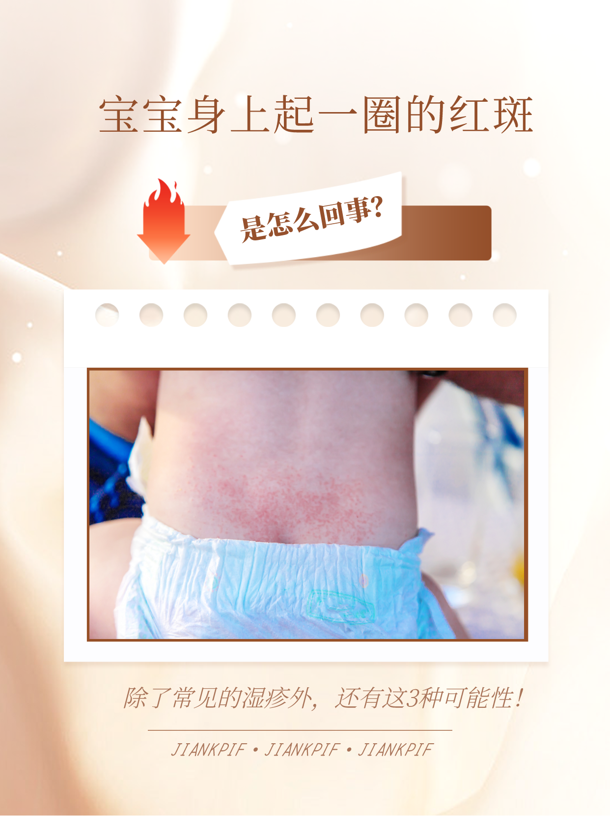 身上红斑是什么?原因和缓解方法
