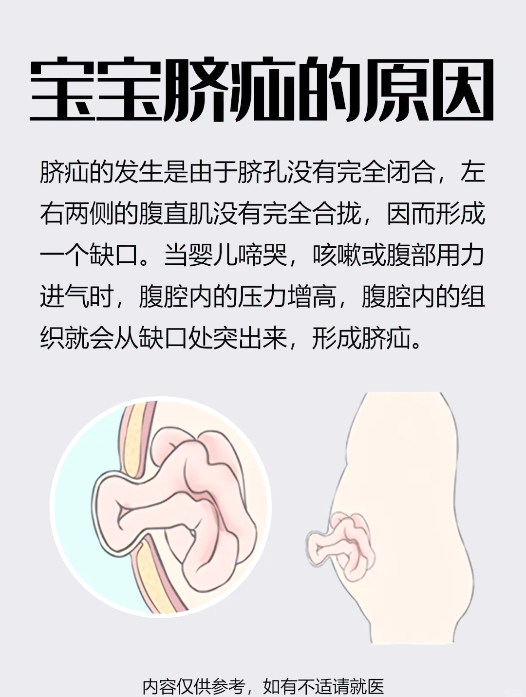引起脐疝的原因有哪些
