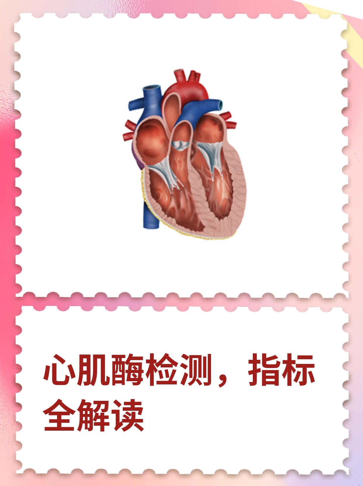 心肌酶检查