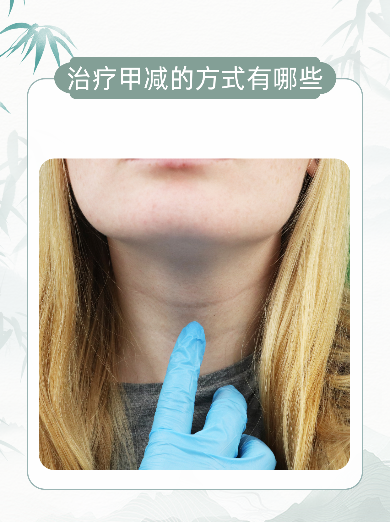 治疗甲减的最好方法??
