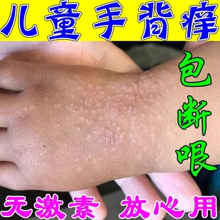 宝宝手上有小红点是什么??