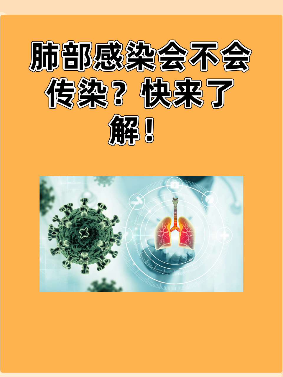 肺积水会传染吗