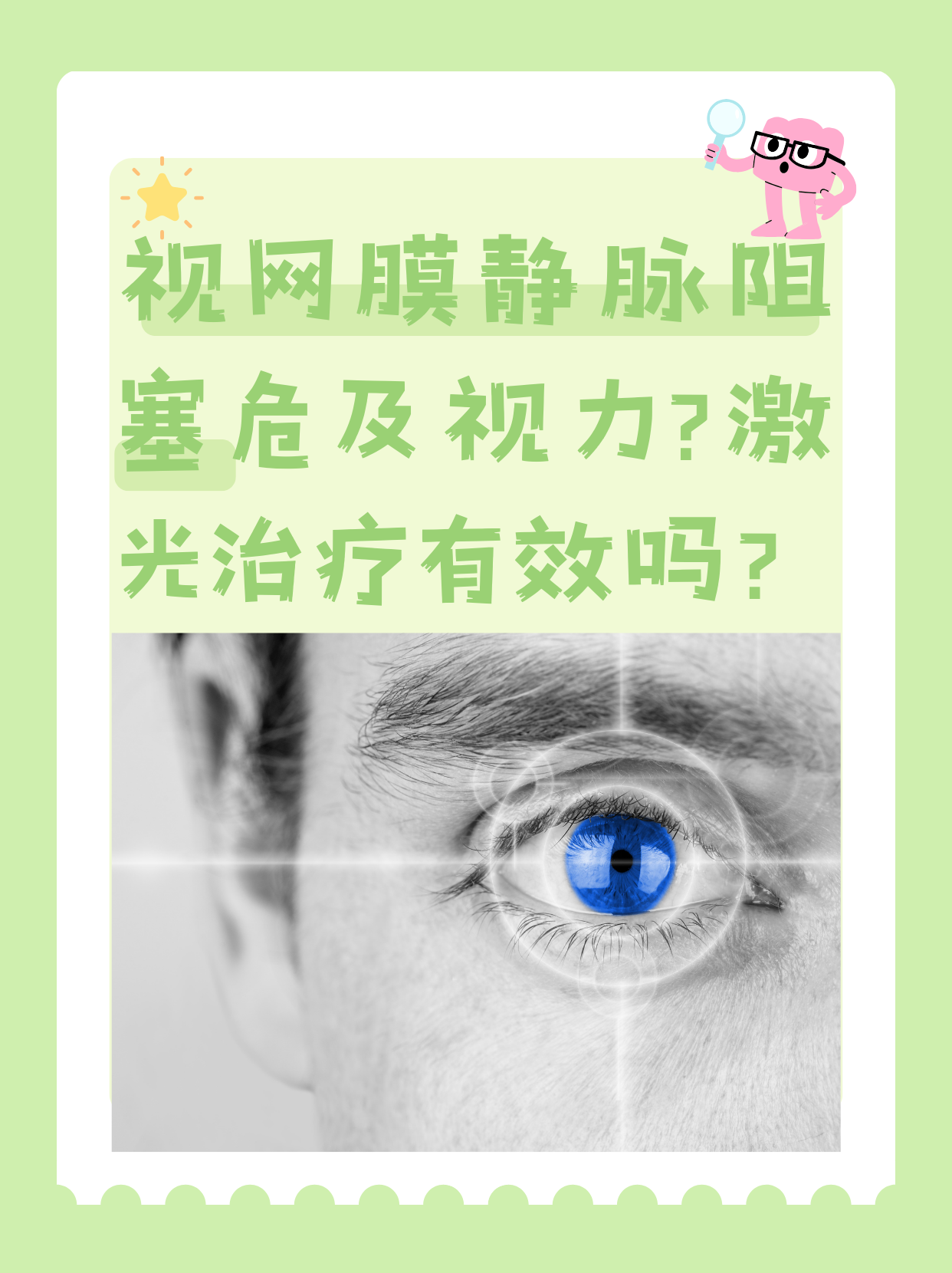 什么叫视网膜静脉阻塞