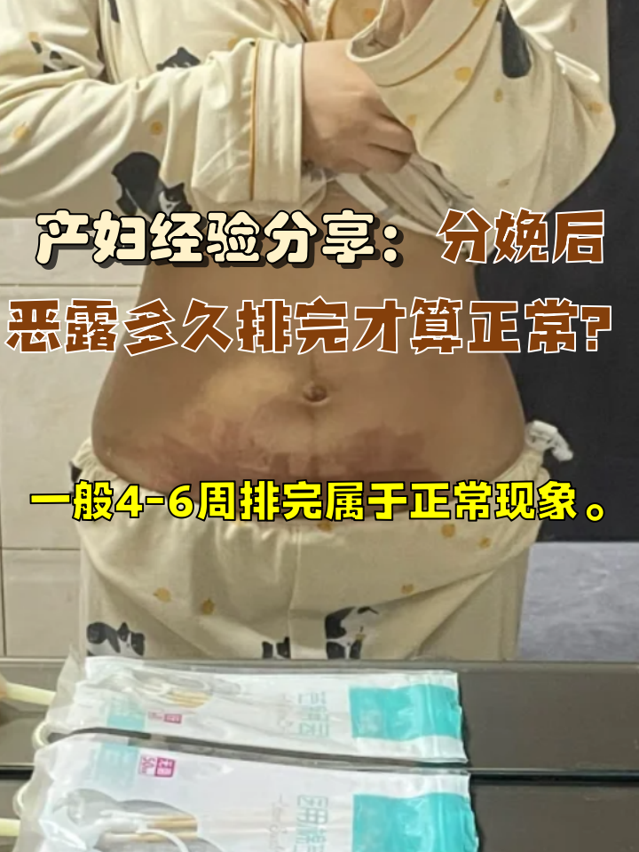 引产后恶露多久干净算正常