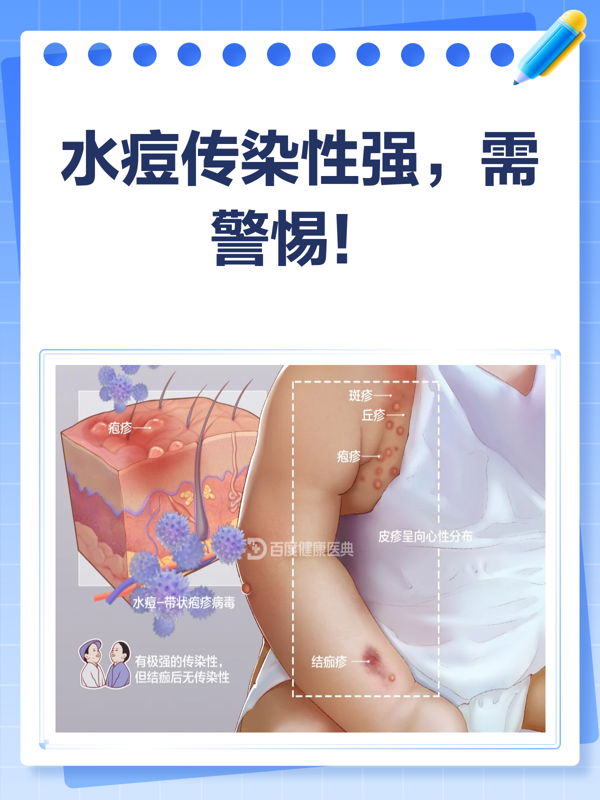水痘会传染大人吗