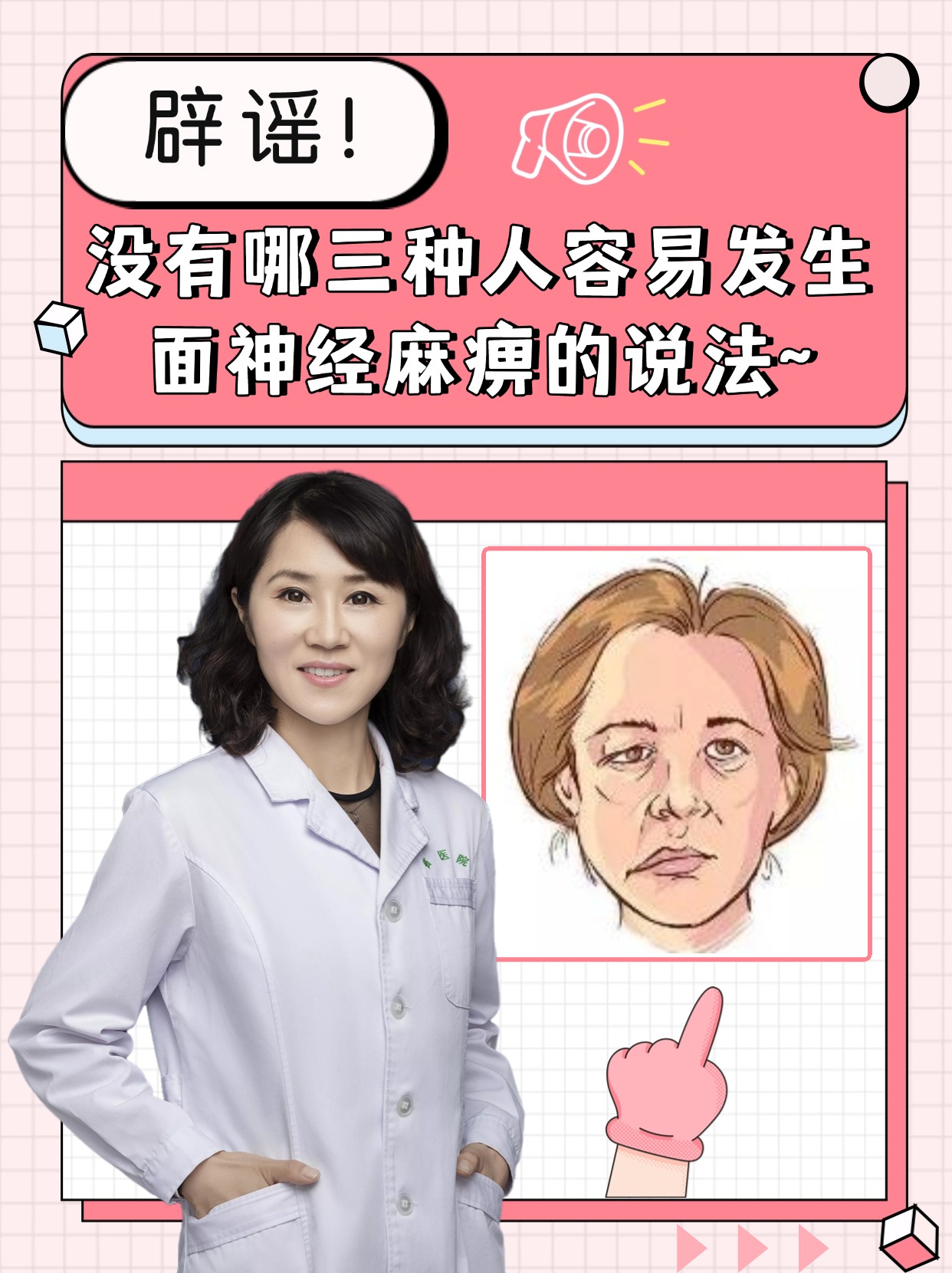 什么是特发性面神经麻痹