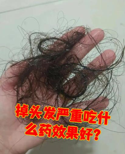女性脱发吃什么好呢?