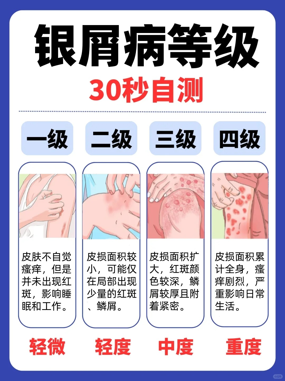 什么是银屑病