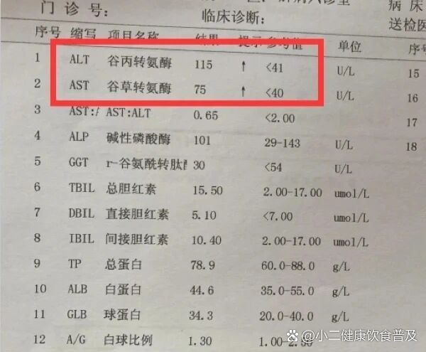 肝功能ast偏高