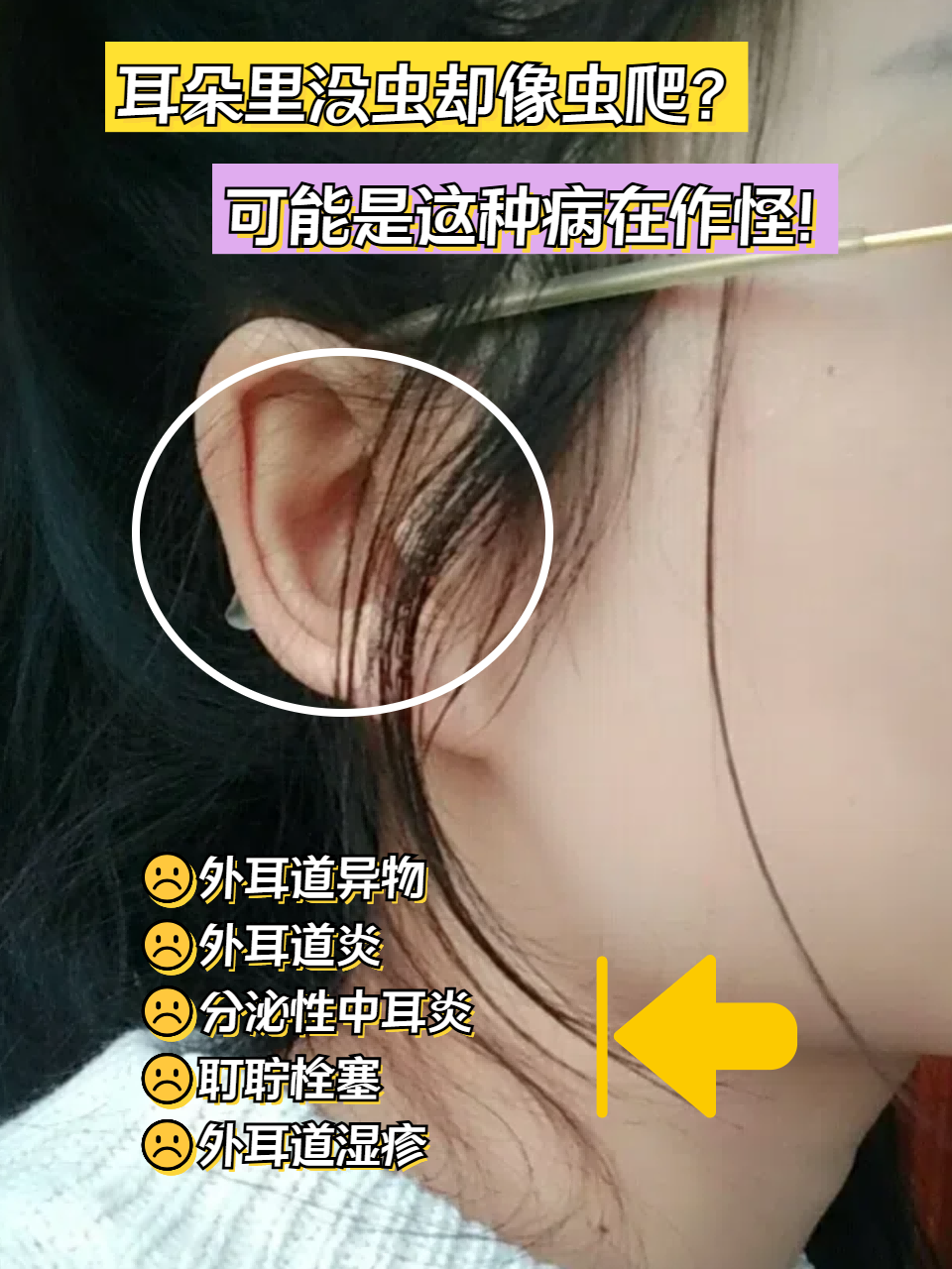 耳朵里面进虫子了,怎么办
