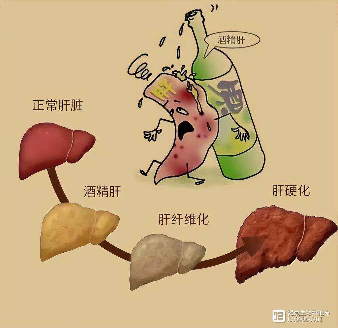 酒精肝能自愈吗?