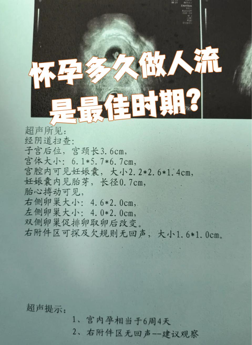 怀孕多久的时间可以做人流?