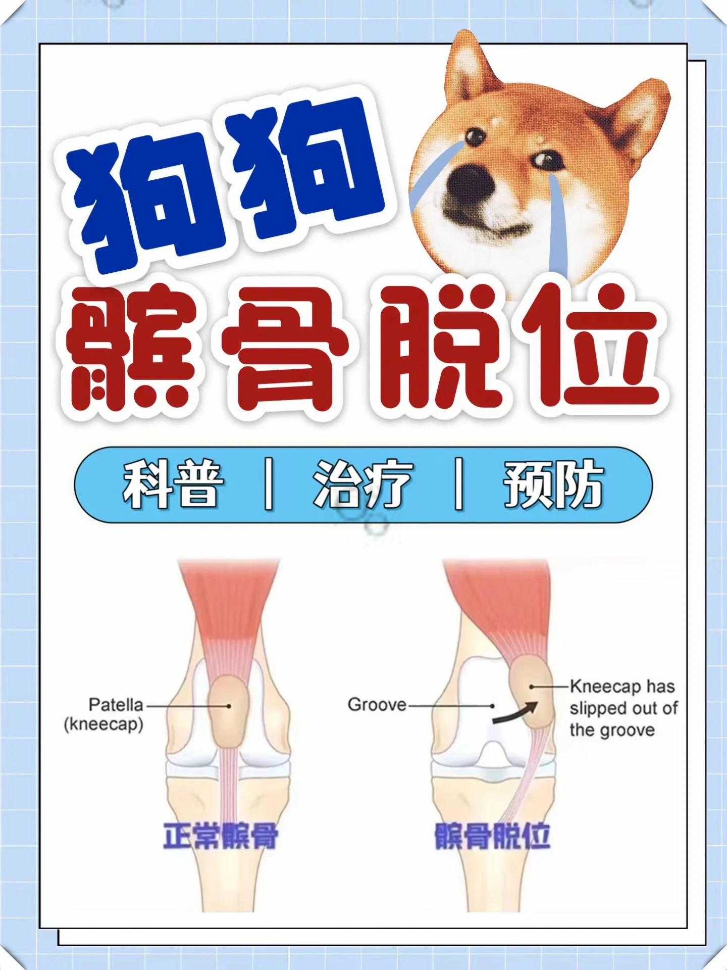 髌骨在哪里