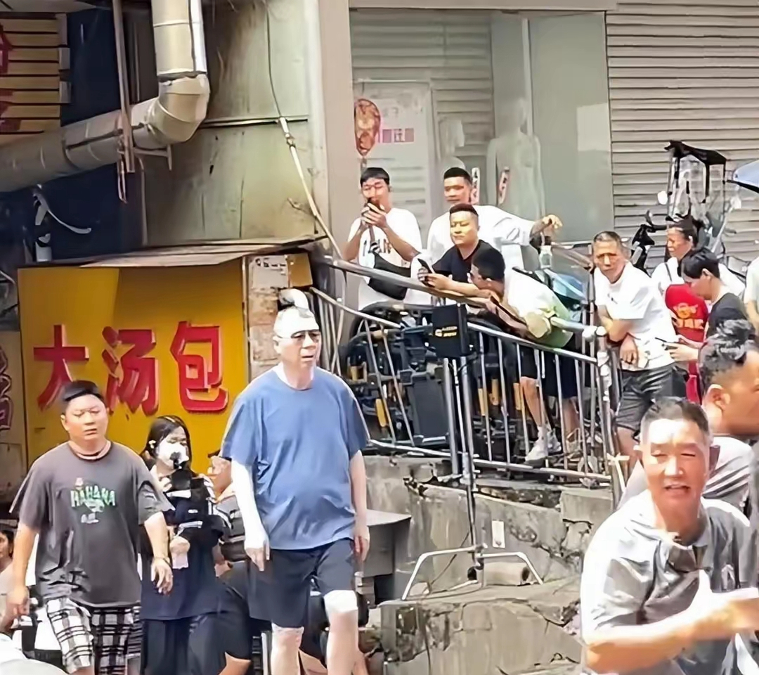 冯小刚白斑自愈了