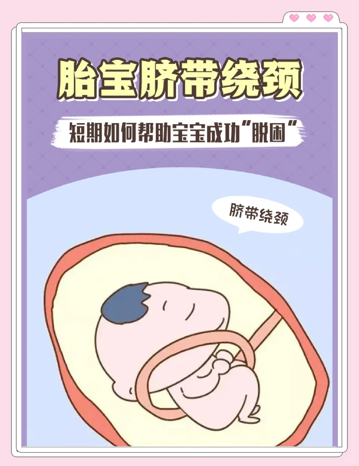 脐带绕颈一圈怎么矫正