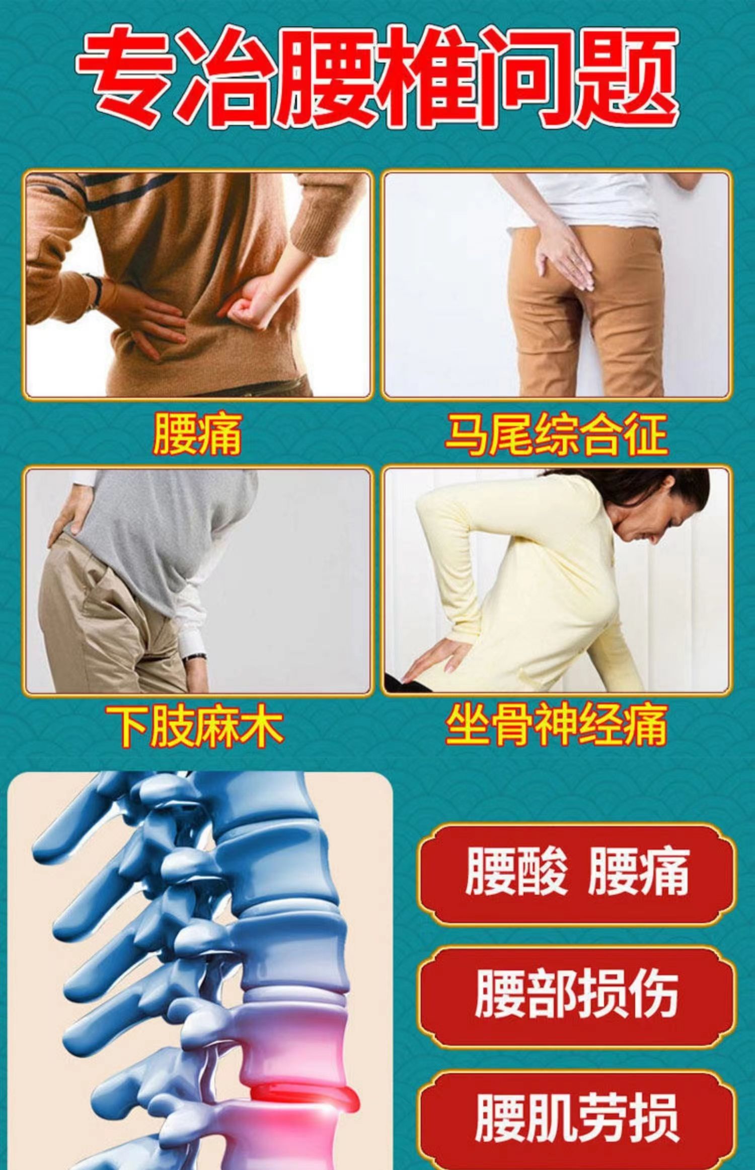 坐骨神经痛挂什么科