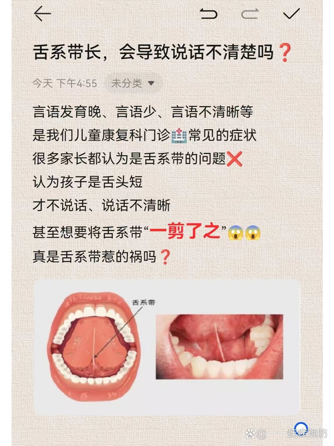 说话说不清楚,这是什么病