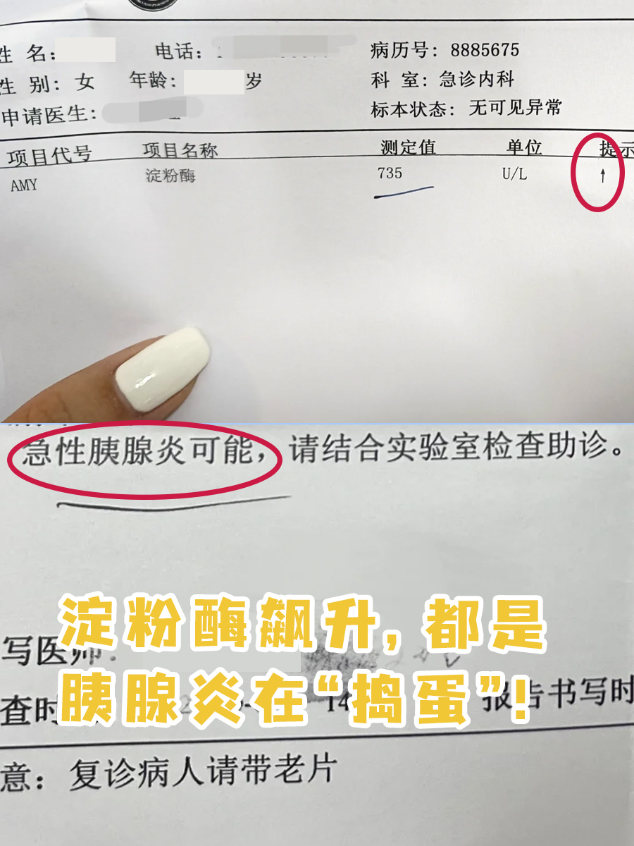 胰腺炎怎么检查出来