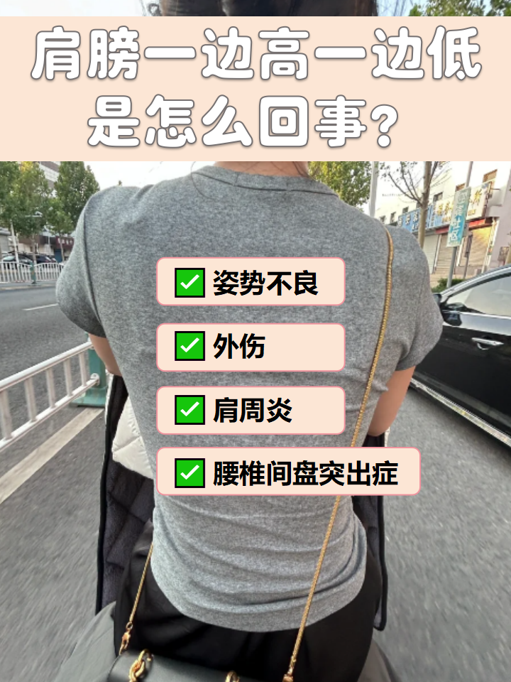 肩周炎该怎么办