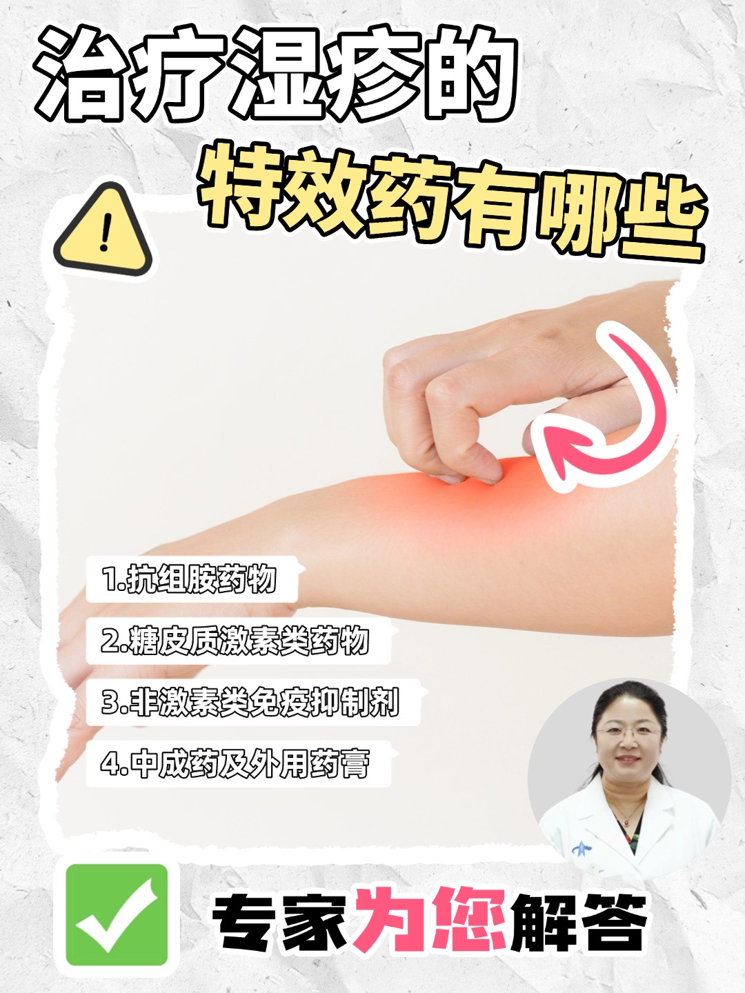 湿疹的治疗