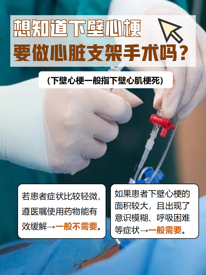 心脏支架手术的利与弊