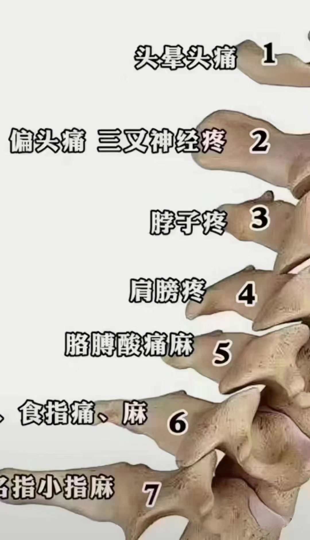 颈椎的特征