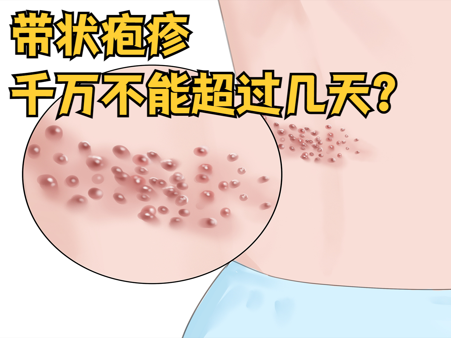 如何治疗皮疹