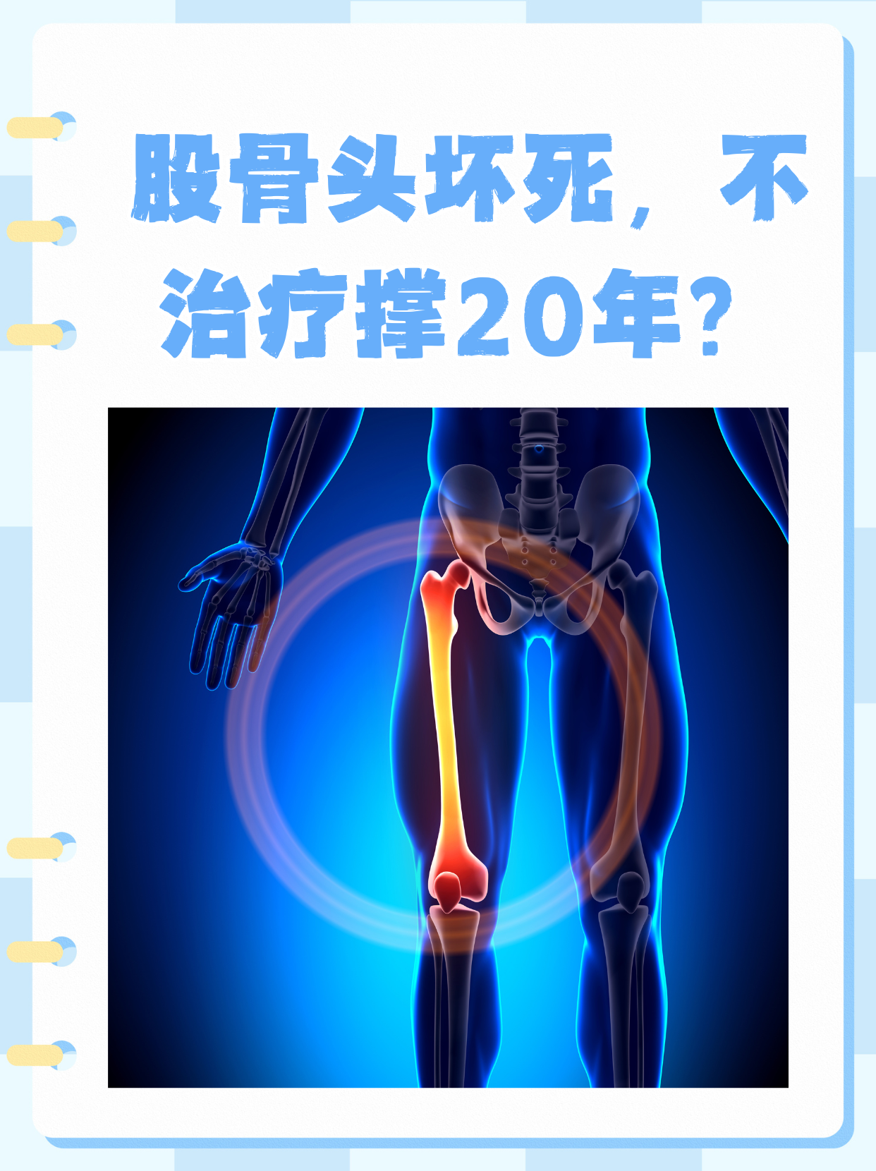 股骨头坏死出现症状是哪些