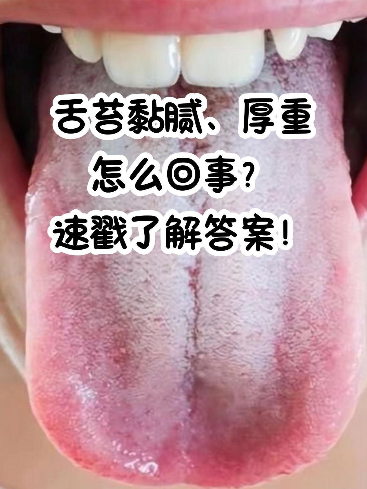 舌苔发白怎么回事?