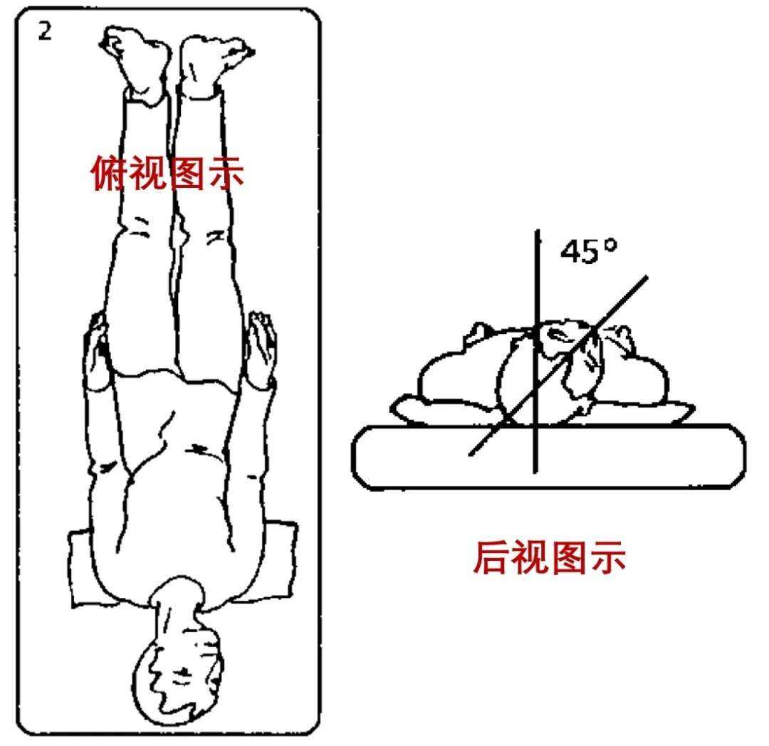 耳石症复位后有哪些注意事项?