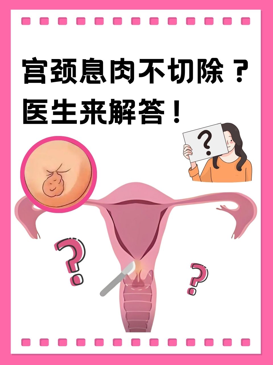 宫颈息肉是由什么原因引起的