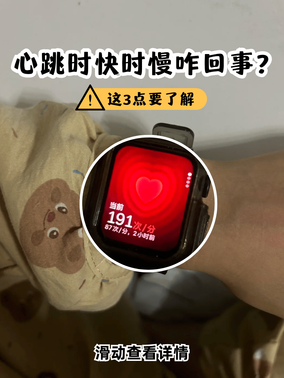 心脏跳动慢怎么治疗