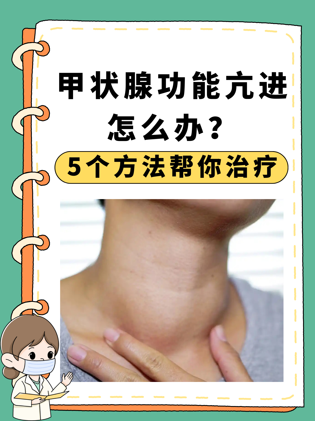 甲亢怎么治疗最好