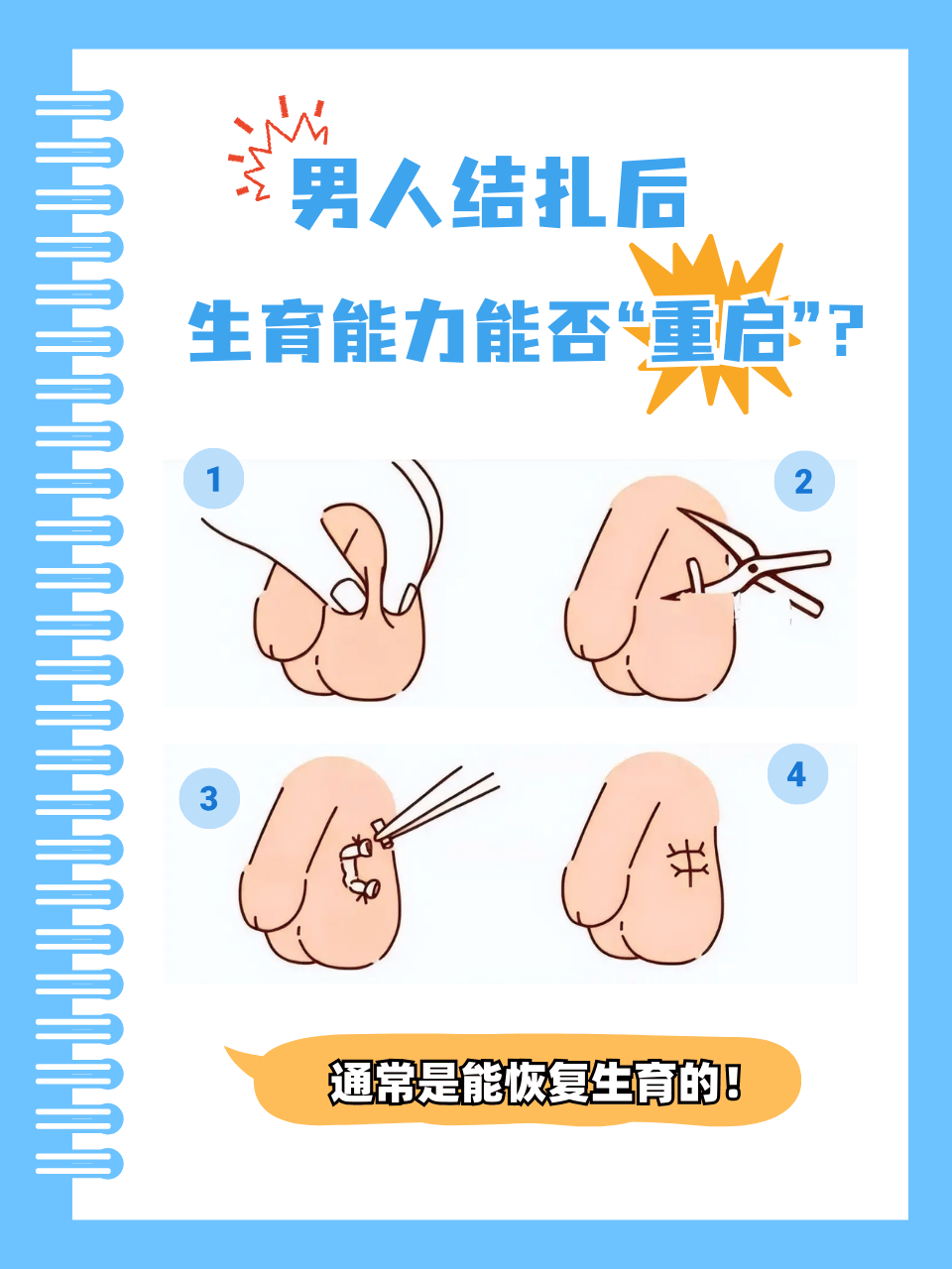 避孕的方法有哪些