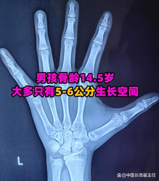 骨骺线闭合的增高方法