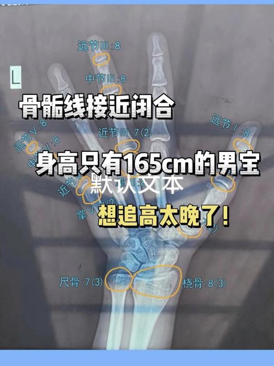 骨骺线闭合的增高方法