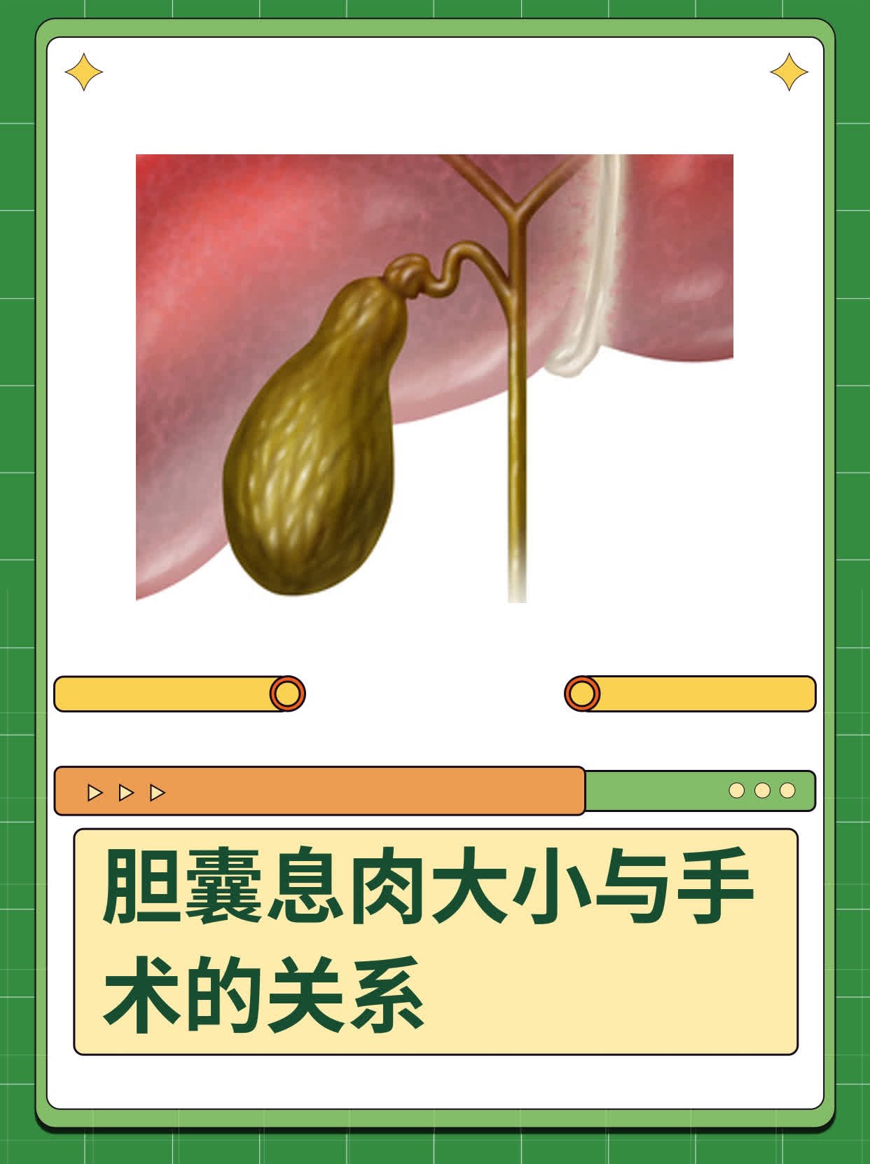 胆囊大小正常值