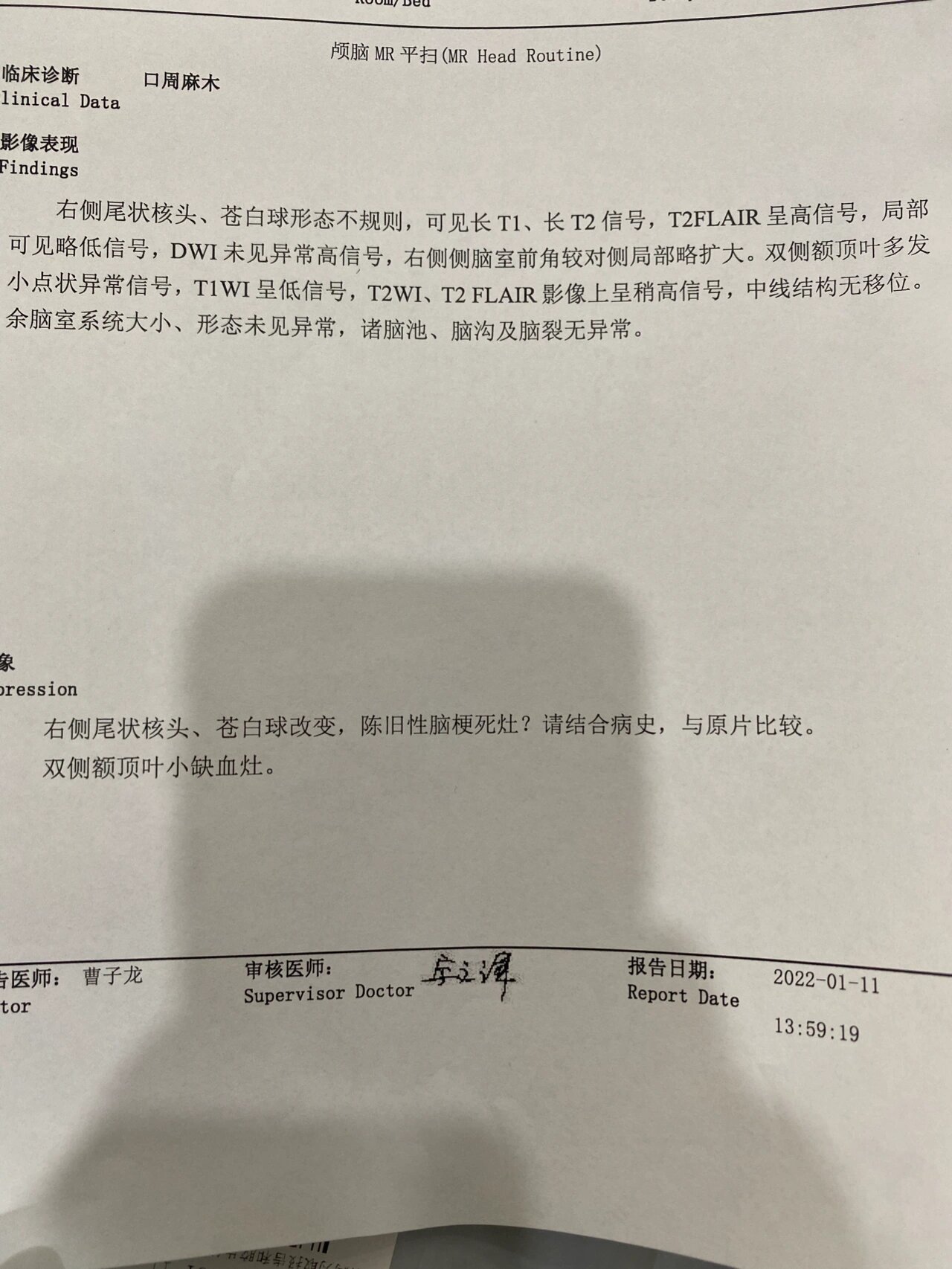 头部核磁共振检查费用要多少