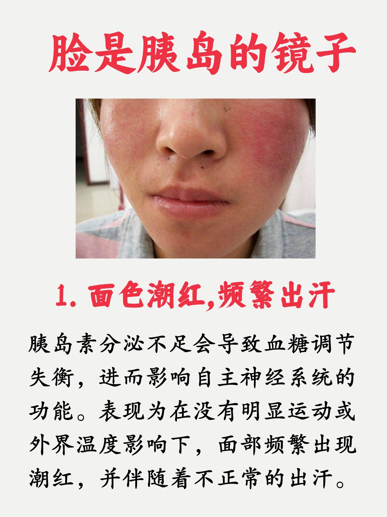 糖尿病晚期的症状是什么